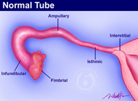 Illustration of the segments of the fallopian tube.