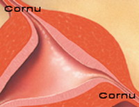 The uterine cornua is the area where the fallopian tube emerges from the uterus.