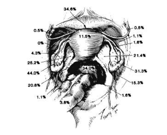 Endometriosis can be a cause of tubal ligation pain