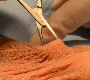 Demonstration of the minimally invasive no scalpel vasectomy reversal