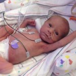 Baby born after Novasure endometrial ablation