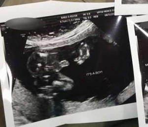 Colonial-Heights-Virginia-tubal-reversal-baby