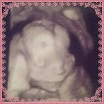ultrasound-of-tubal-reversal-baby-girl