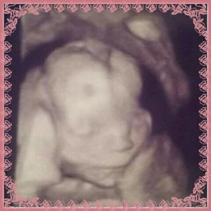 baby girl 4d photo