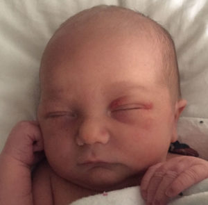 tubal-reversal-baby-from-hebron-indiana