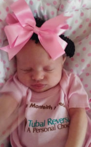 olio-tubal-clip-reversal