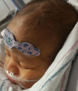 tubal-reversal-baby-from-mebane-nc