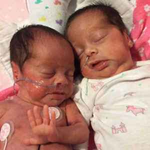 tubal-reversal-twins-from-Fouke-AR