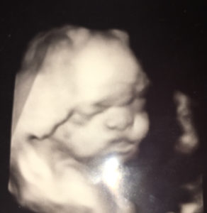 awaiting-our-bundle-of-joy