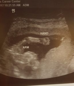 19-weeks-pregnant-with-baby-girl