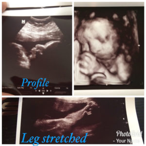 tubal-reversal-baby-from-elizabeth-city-nc