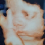 36-weeks-pregnant-marydel-DE-tubal-reversal-baby
