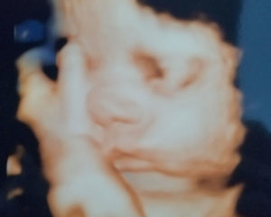 36-weeks-pregnant-marydel-DE-tubal-reversal-baby