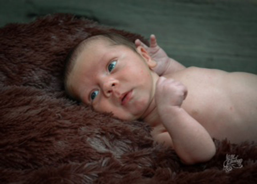 SC-mom-age-43-with-successful-reversal-of-burned-tubes