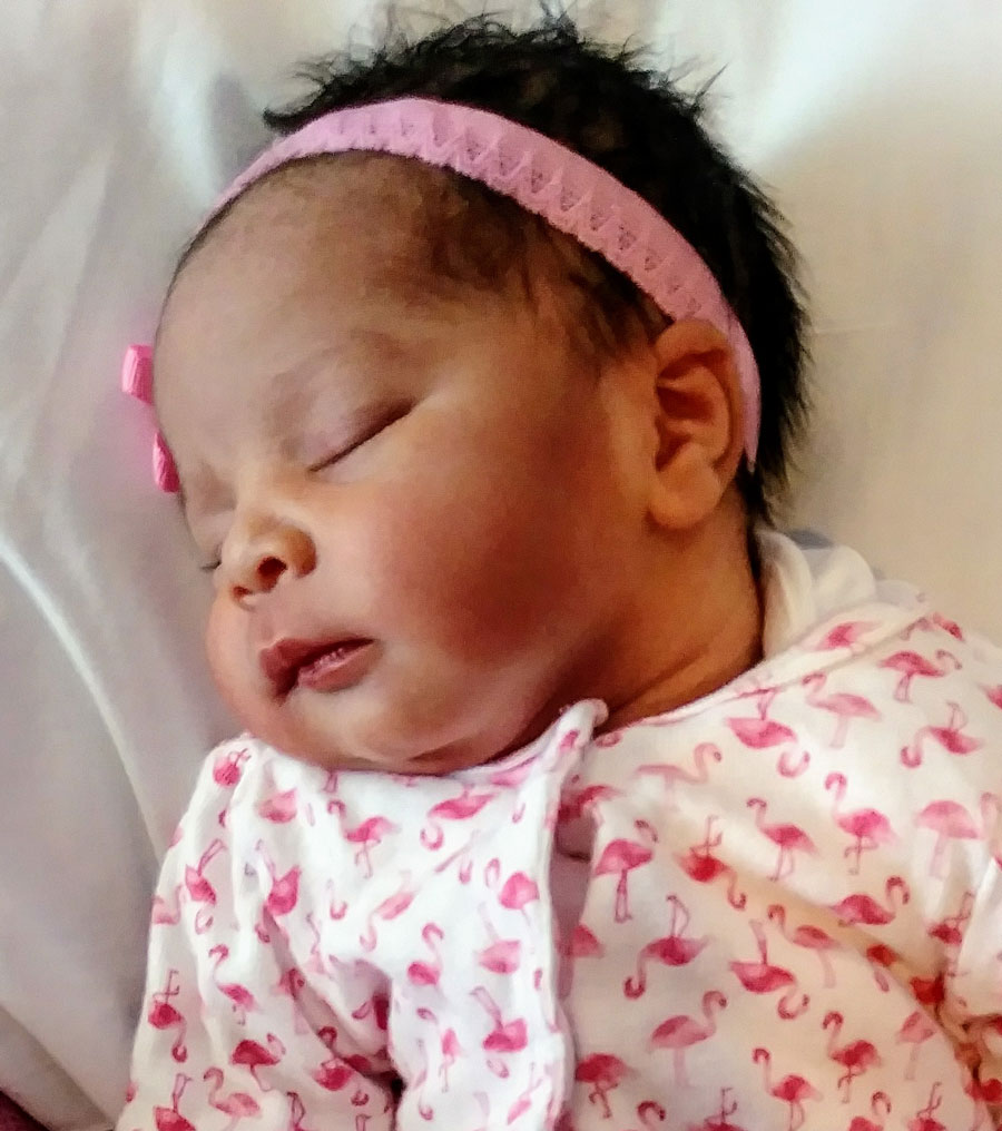 removing-tubal-clips-with-dr-monteith-can-work