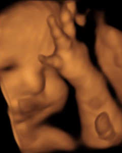 mom-age-45-pregnant-after-tubal-reversal