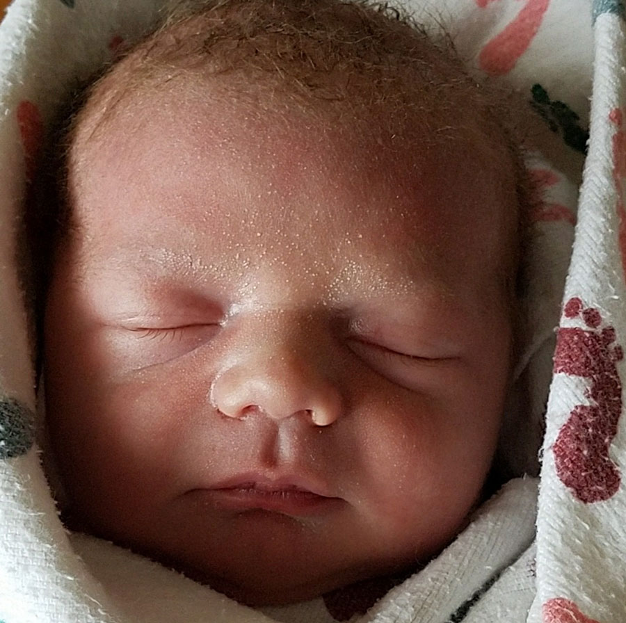 Essure-reversal-omaha-baby-from-dr-monteith