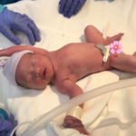 second-essure-reversal-baby-loved-by-all