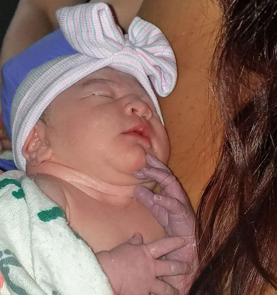 Adiana-reversal-with-dr-monteith