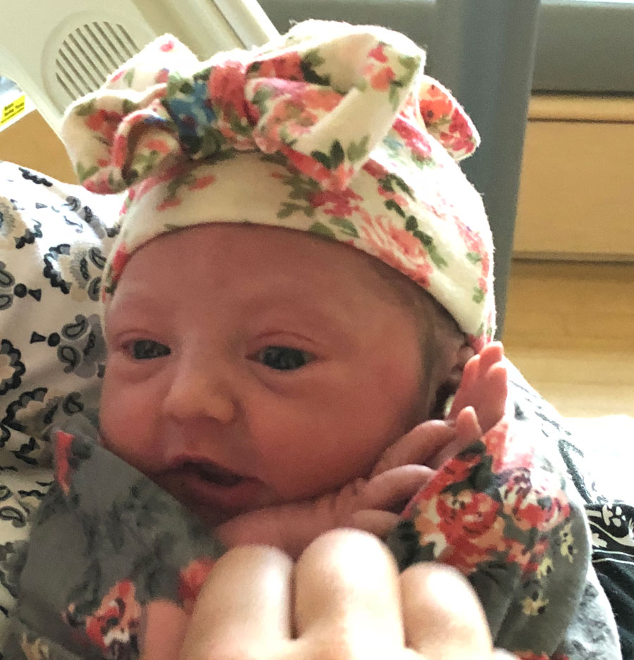 Essure-reversal-WA-perfect-surgery-with-perfect-results