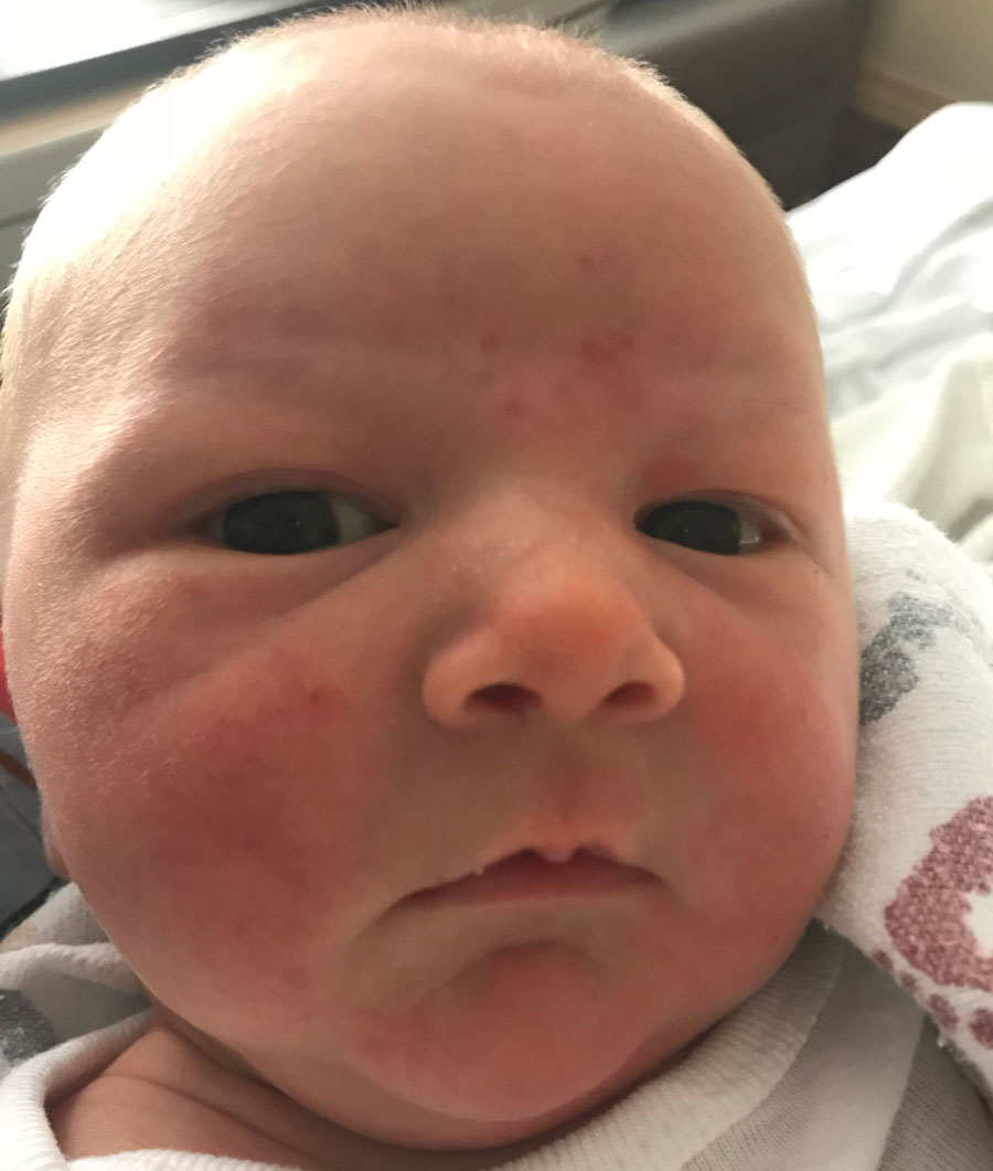 best-tubal-reversal-doctor-in-world