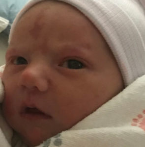 tubal-reversal-baby-after-reversing-cut-tied-tubes