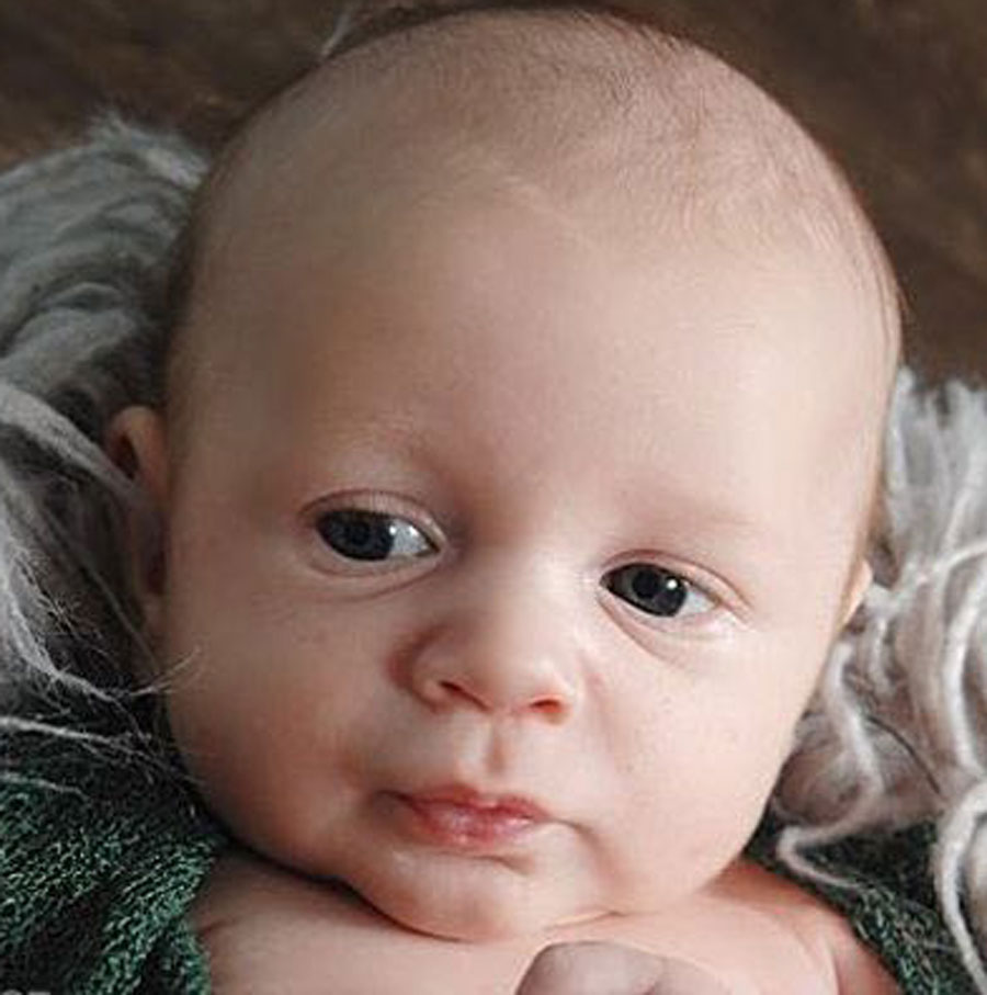 great-results-after-reversing-tubal-clips-with-dr-monteith