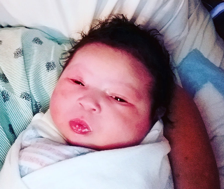 how-long-to-get-pregnant-after-tubal-reversal