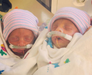 naturally-conceived-twins-after-tubal-reversal-surgery