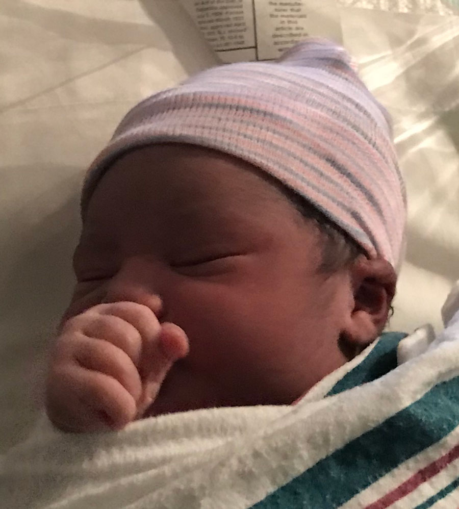 fort-gordon-tubal-reversal-of-burned-tubes-baby-born-after-reversal-surgery