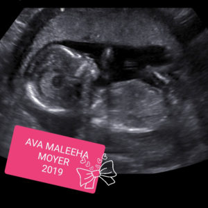 family-complete-third-tubal-reversal-baby