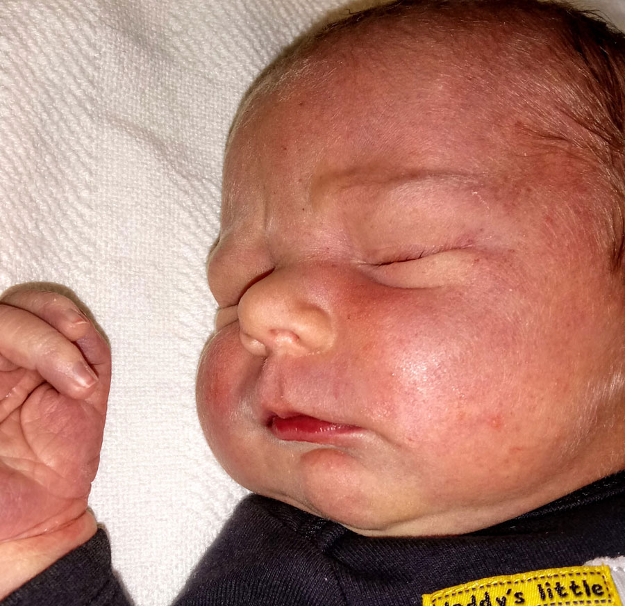 tubal-reversal-bringing-another-baby-into-world