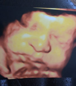 never-lose-hope-for-getting-pregnant