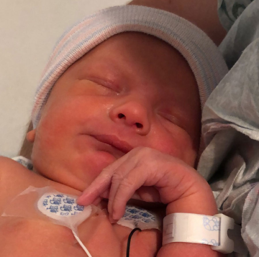 tubes-reversed-after-being-tied-for-9-years