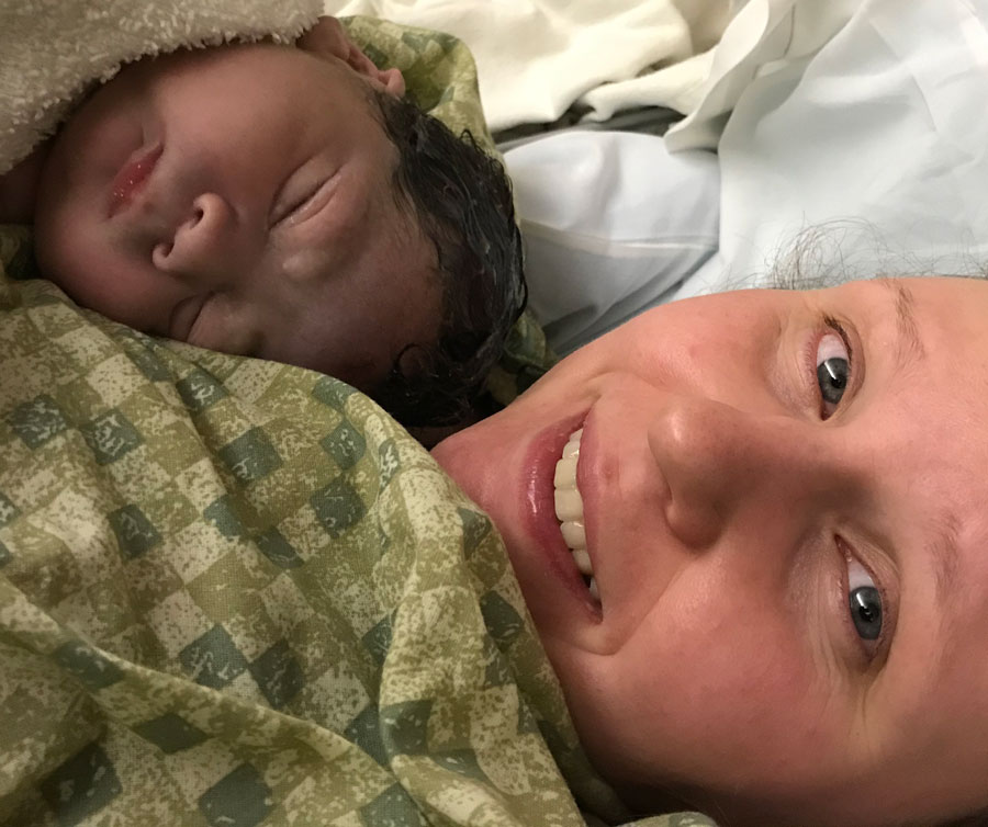 reversing-tubal-clips-vancouver-WA