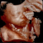 30-weeks-gestation-tubal-reversal-baby-meridian-idaho