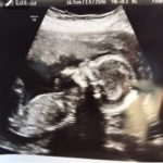 20-week-ultrasound-showed-it-is-a-boy