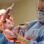 44-year-old-mom-has-essure-reversal-baby-by-c-section