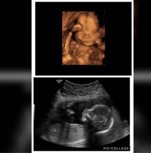 reversing-burned-tubes-with-dr-monteith-was-worth-the-cost