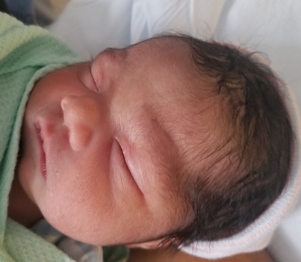 reversing-tied-and-cut-tubal-ligation-with-dr-monteith-second-reversal-baby