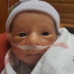 second-reversal-baby-after-reversing-burned-tubes-colorado