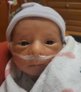 second-reversal-baby-after-reversing-burned-tubes-colorado