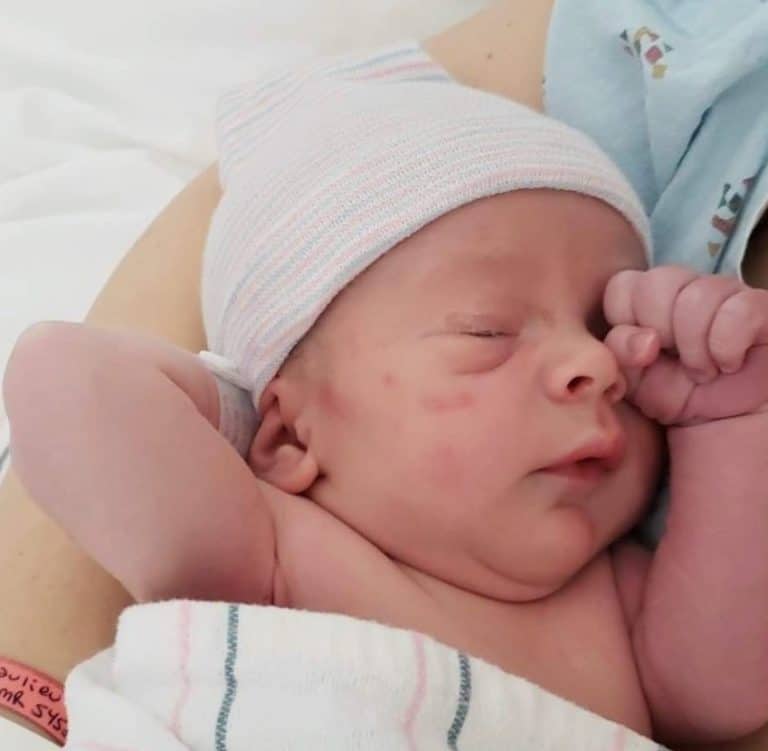 Can Burned Tubes Be Reversed? What Are Chances Of Getting Pregnant?