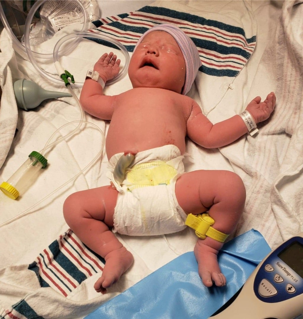 tubal-reversal-surgery-worked-right-away
