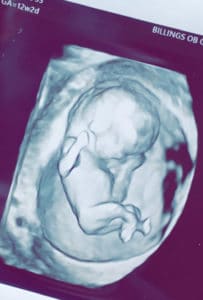 mom-from-montana-with-tubal-reversal-baby-girl