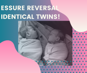 Essure-reversal-identical-twin-girls-born-after-surgery-with-dr-monteith