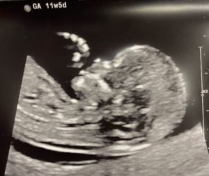 baby-measuring -one-week-ahead-of-schedule