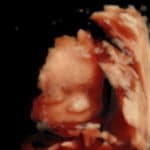 four-chemical-pregnancies-now-with-keeper