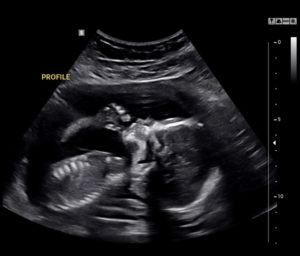 cant-wait-to-meet-baby-girl