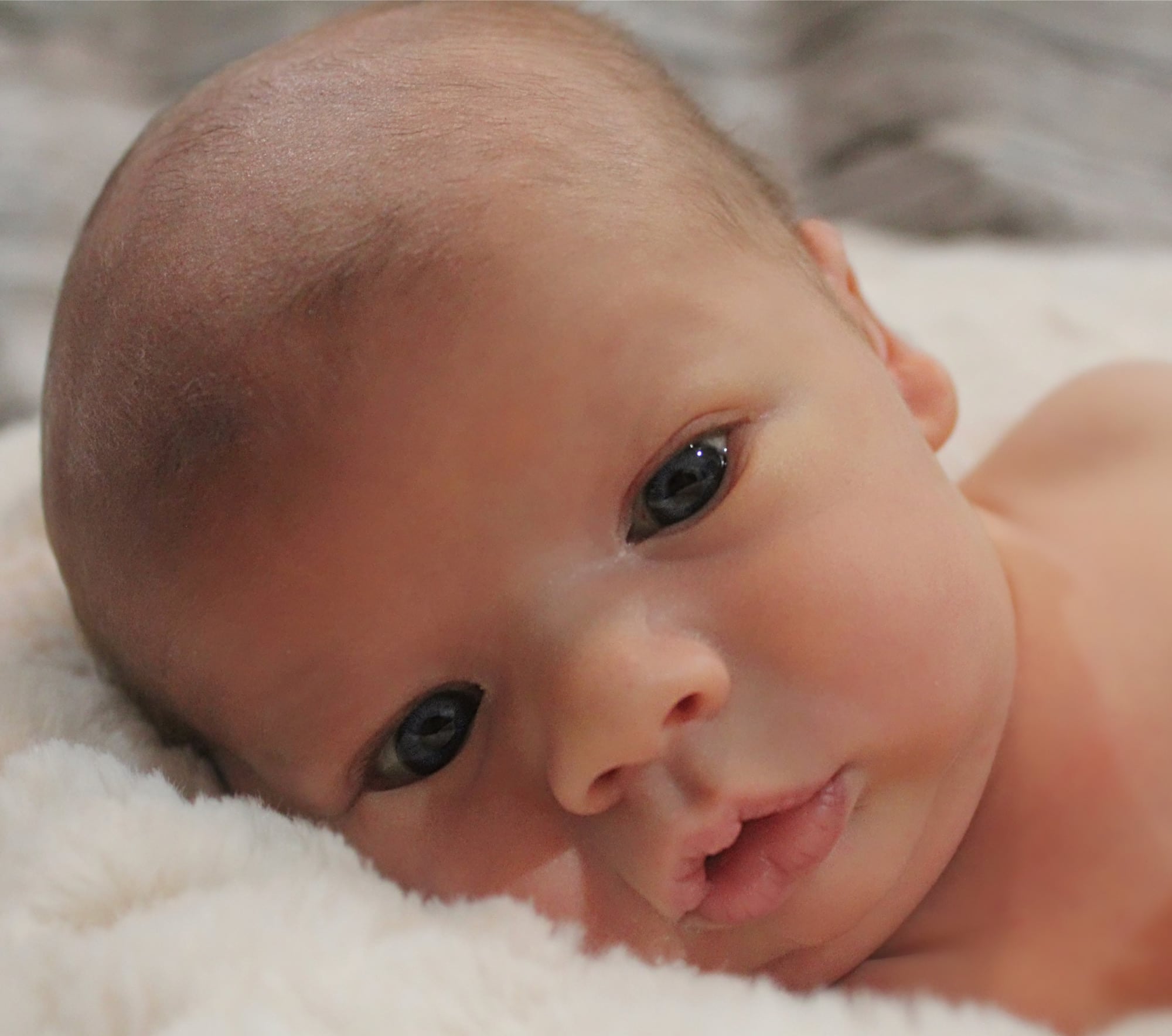 fertility-doctor-skeptical-about-essure-reversal-surgery